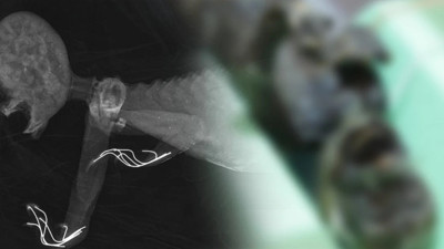 Deniz kızı efsanesinde ürküten keşif. Başı maymun ortası balık