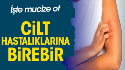 Cilt hastalıklarına birebir. İşte mucize ot