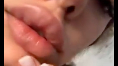 Dudak dolgusu yaptıran genç kıza babasının verdiği tepki gündem oldu