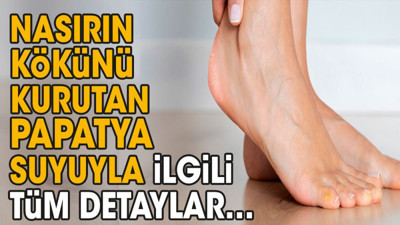 Nasırın kökünü kurutan papatya suyuyla ilgili tüm detaylar…