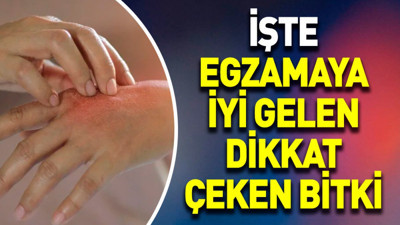 İşte egzamaya iyi gelen dikkat çeken bitki