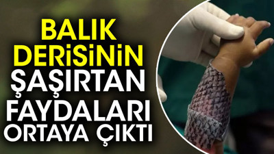 Balık derisinin şaşırtan faydaları ortaya çıktı