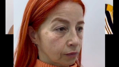 Küçük estetik dokunuşlar sonrası halini görenler tanıyamadı... 20 yaş gençleşti