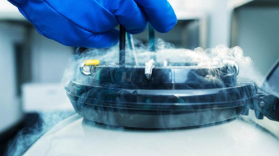 Sperm dondurma işlemi nasıl uygulanır