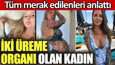 İki üreme organı olan kadın tüm merak edilenleri cevapladı