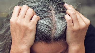 Beyaz saçlara nasıl veda edilir