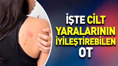 İşte cilt yaralarının iyileştirebilen ot