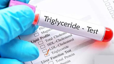 Trigliserid tam bir baş belası