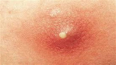 Sıkmayın öldürebilir