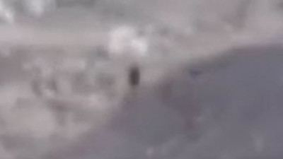 Ankara'da çocuğa domuz saldırdı