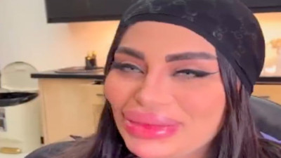 İranlı kadınların büyük dudak tutkusu