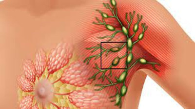 Meme kanseri olduğunuzu anlamanın en kolay yolları