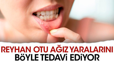 Reyhan otu ağız yaralarını böyle tedavi ediyor