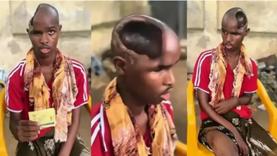 Beyni olmayan adam görenleri şoke etti. ‘Gizli yetenekleri ortaya çıkabilir’