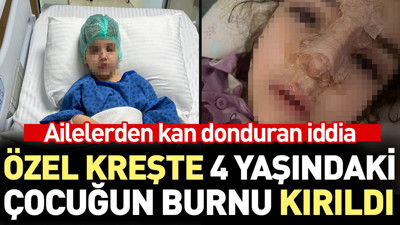 Özel kreşte 4 yaşındaki çocuğun burnu kırıldı. Ailelerden kan donduran iddia