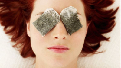 Göz altı torbaları ve mor halkalar neden oluşur? Tedavisi nasıl olur? Nasıl geçer?