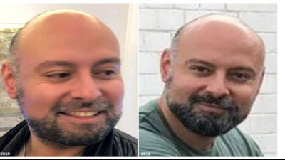 Interpol bu Türk’ü arıyor. 45 milyon euro ile ortadan kayboldu