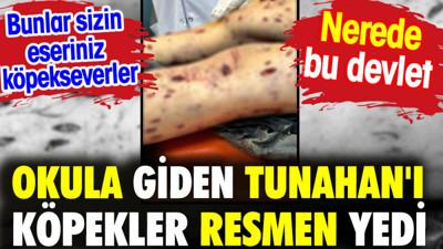 Ankara'da okula giden Tunahan'ı köpekler resmen yedi. Bunlar sizin eseriniz köpekseverler