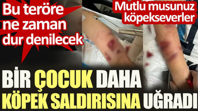 Bir çocuk daha köpek saldırısına uğradı. Bu teröre ne zaman dur denilecek