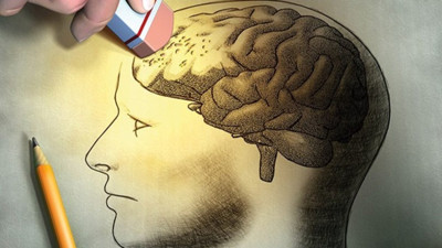 Stres Alzhemeir mi yapıyor