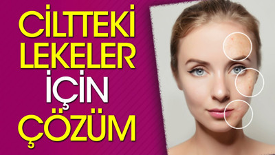 Ciltteki lekeler için çözüm