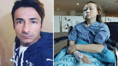 Eşinin yüzünü falçatayla kesti 'Suça meyilli değilim' dedi tahliye oldu