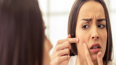 İşte sivilceleri ve ciltteki lekeleri tedavi eden ot