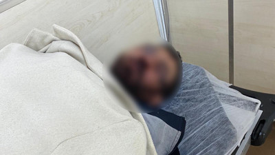 Boşanmak isteyen kocanın başına gelmeyen kalmadı. Önce öldüresiye dövüldü sonra babasının aracı tarandı