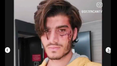 Bir Türk, Sırbistan'da Suriyeliler tarafından gasp edildikten sonra Sırp polislerden şiddet gördüğünü anlattı