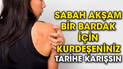 Sabah akşam bir bardak için kurdeşeniniz tarihe karışsın