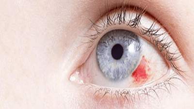 Sinsice belirti vermeden geliyor kör bırakıyor