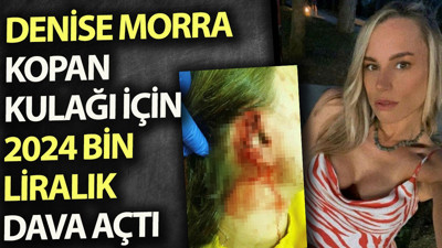 Denise Morra kopan kulağı için 2024 bin liralık dava açtı