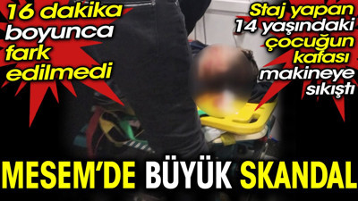 MESEM’de büyük skandal. Staj yapan 14 yaşındaki çocuğun kafası makineye sıkıştı