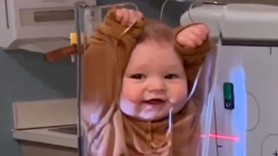 Bugün göreceğiniz en sevimli şey: Röntgen çekilen sevimli bebek