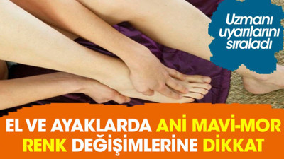 El ve ayaklarda ani mavi-mor renk değişimlerine dikkat. Uzmanı uyarılarını sıraladı