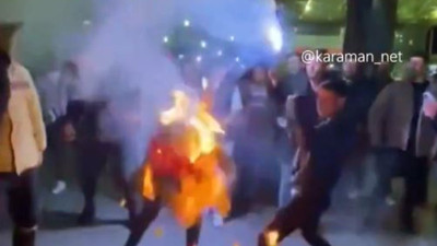 Askere giden arkadaşının yüzünü ve kafasını yaktılar! Uğurlama eğlencesinde görülmemiş olay