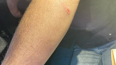 Oto sanayide sokak köpekleri saldırdı