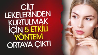 Cilt lekelerinden kurtulmak için 5 etkili yöntem ortaya çıktı