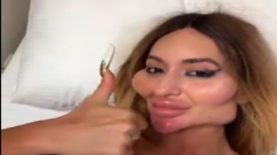 Estetik bağımlısı kadın, dünyanın en büyük elmacık kemiklerine sahip olmak için İstanbul'da operasyon geçirdi