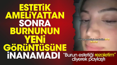 Estetik ameliyattan sonra burnunun yeni görüntüsüne inanamadı. Burun estetiği rezaletim diyerek paylaştı