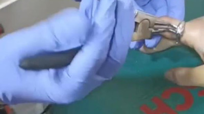 Parmakta sıkışan yüzüğü itfaiye çıkardı