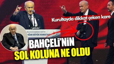 Devlet Bahçeli’nin sol koluna ne oldu? MHP’den kurultay günü resmi açıklama geldi