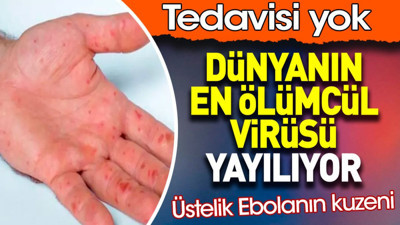 Dünyanın en ölümcül virüsü yayılıyor. Tedavisi yok. Ebolanın kuzeni