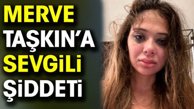 Sosyal medya fenomeni Merve Taşkın sevgilisinden gördüğü şiddeti paylaştı
