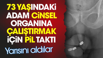 73 yaşındaki adam cinsel organına çalıştırmak için pil taktı. Yarısını aldılar