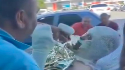 Yanıkları daha yeni sargılanmışken sedyede sigara yakıp içmeye çalıştı