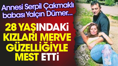 28 yaşındaki kızları Merve güzelliğiyle mest etti. Annesi Serpil Çakmaklı babası Yalçın Dümer...