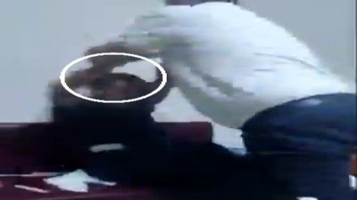 Hastanede tekme tokat kavga: Müdür yardımcısı ile tekniker birbirine girdi