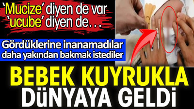 Bebek kuyrukla dünyaya geldi. ‘Mucize’ diyen de var ‘ucube’ diyen de…