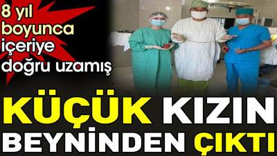 Küçük kızın beyninden çıktı. 8 yıl boyunca içeriye doğru uzamış